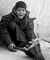 One of the children suffering from the Civil War
